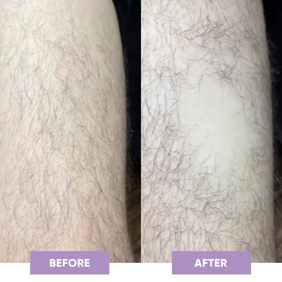 Resultado before and after WEIN