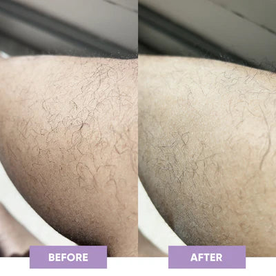 Resultado before and after WEIN